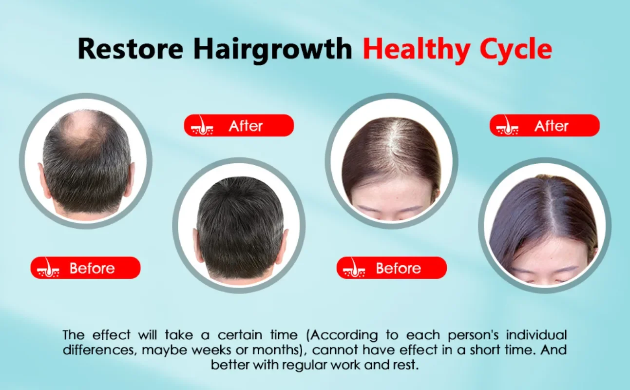 Bonnet de croissance des cheve - Hair Care Basic avis et prix